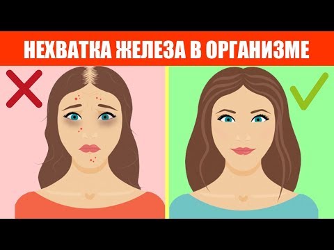 Видео о препарате Монофер (Monofer) 1000мг - 100мг/мл 10мл ампула №1